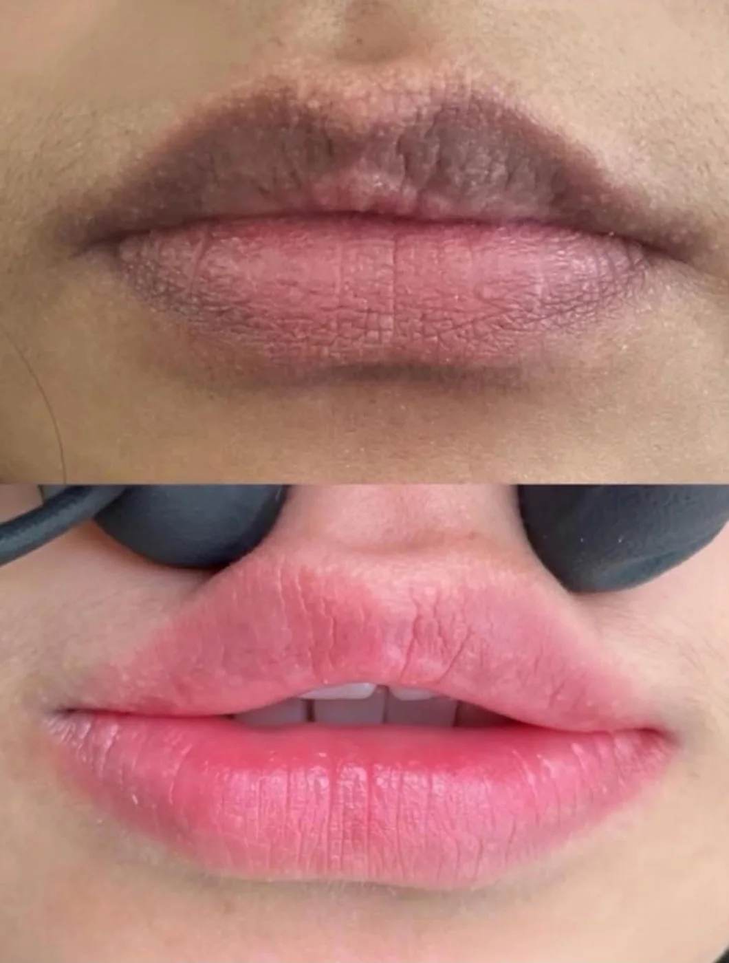 Soft Lip Blush Before & After