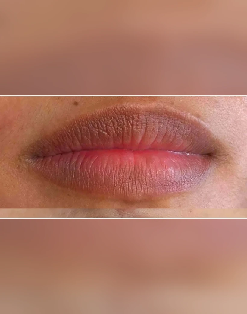 Before: Lip Color Transformation