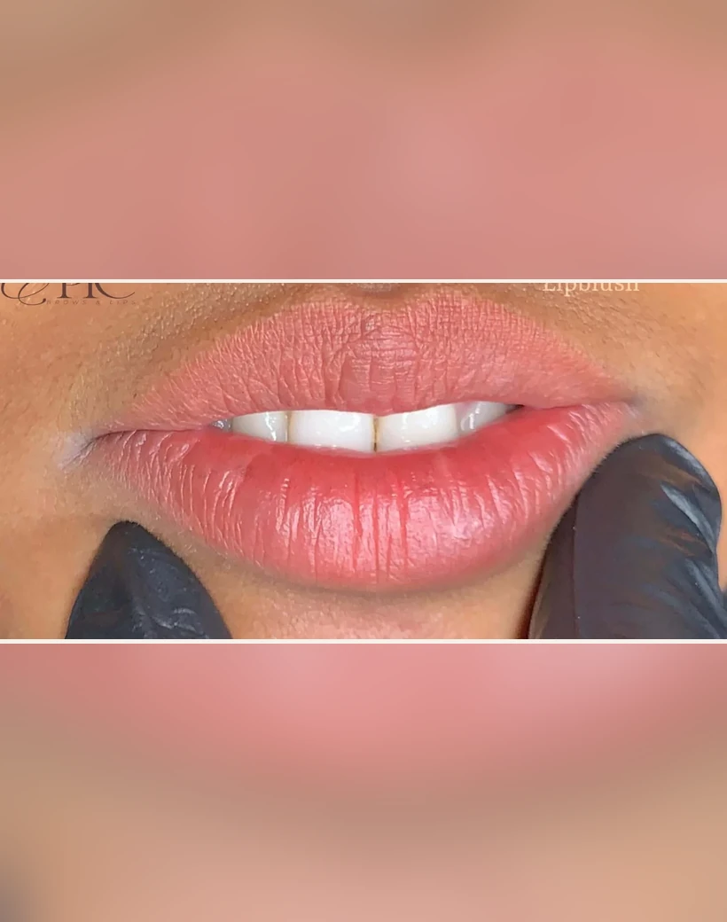 After: Lip Neutralization & Blush