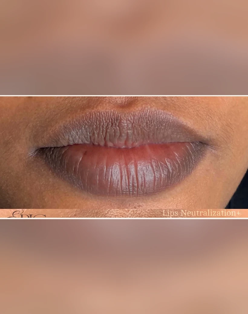 Before: Lip Neutralization & Blush
